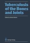 Image for Tuberculosis of the Bones and Joints