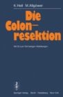 Image for Die Colonresektion