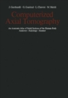 Image for Computerized Axial Tomography