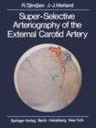 Image for Super-Selective Arteriography of the External Carotid Artery