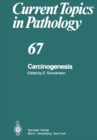 Image for Carcinogenesis : 67