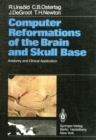 Image for Computer Reformations of the Brain and Skull Base: Anatomy and Clinical Application