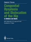 Image for Congenital Dysplasia and Dislocation of the Hip in Children and Adults