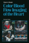Image for Color Blood Flow Imaging of the Heart
