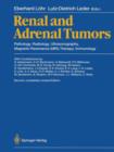 Image for Renal and Adrenal Tumors