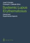 Image for Systemic Lupus Erythematosus