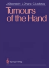 Image for Tumours of the Hand