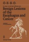 Image for Benign Lesions of the Esophagus and Cancer : Answers to 210 Questions