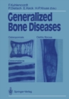 Image for Generalized Bone Diseases: Osteoporosis Osteomalacia Ostitis fibrosa