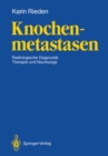 Image for Knochenmetastasen: Radiologische Diagnostik, Therapie Und Nachsorge