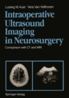Image for Intraoperative Ultrasound Imaging in Neurosurgery: Comparison with CT and MRI