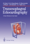 Image for Transesophageal Echocardiography: A New Window to the Heart