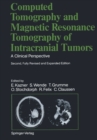 Image for Computed Tomography and Magnetic Resonance Tomography of Intracranial Tumors: A Clinical Perspective