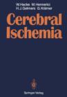 Image for Cerebral Ischemia
