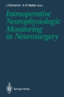 Image for Intraoperative Neurophysiologic Monitoring in Neurosurgery
