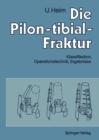 Image for Die Pilon-tibial-fraktur: Klassifikation, Operationstechnik, Ergebnisse.