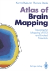 Image for Atlas of Brain Mapping: Topographic Mapping of EEG and Evoked Potentials