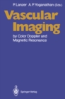 Image for Vascular Imaging by Color Doppler and Magnetic Resonance
