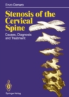 Image for Stenosis of the Cervical Spine: Causes, Diagnosis and Treatment