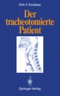 Image for Der tracheotomierte Patient