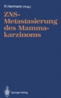 Image for Zns-metastasierung Des Mammakarzinoms
