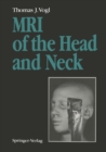 Image for MRI of the Head and Neck: Functional Anatomy - Clinical Findings - Pathology - Imaging