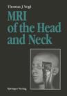 Image for MRI of the Head and Neck