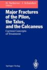 Image for Major Fractures of the Pilon, the Talus, and the Calcaneus : Current Concepts of Treatment