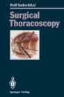 Image for Surgical Thoracoscopy