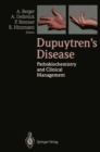 Image for Dupuytren&#39;s Disease: Pathobiochemistry and Clinical Management