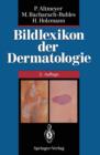 Image for Bildlexikon der Dermatologie