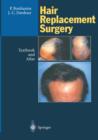 Image for Hair Replacement Surgery