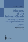 Image for Diseases of the Salivary Glands Including Dry Mouth and Sjogren&#39;s Syndrome: Diagnosis and Treatment