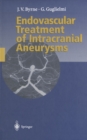 Image for Endovascular Treatment of Intracranial Aneurysms