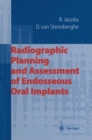 Image for Radiographic Planning and Assessment of Endosseous Oral Implants
