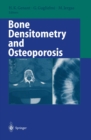 Image for Bone Densitometry and Osteoporosis