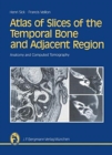 Image for Atlas of Slices of the Temporal Bone and Adjacent Region : Anatomy and Computed Tomography Horizontal, Frontal, Sagittal Sections