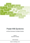 Image for Prader-Willi Syndrome: and Other Chromosome 15q Deletion Disorders