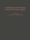 Image for Technique of Internal Fixation of Fractures