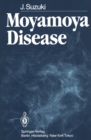 Image for Moyamoya Disease