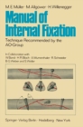 Image for Manual of Internal Fixation: Technique Recommended by the AO-Group Swiss Association for the Study of Internal Fixation: ASIF