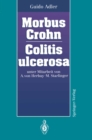 Image for Morbus Crohn Colitis Ulcerosa