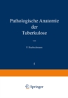 Image for Pathologische Anatomie der Tuberkulose