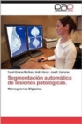 Image for Segmentacion Automatica de Lesiones Patologicas.