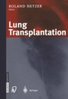 Image for Lung Transplantation