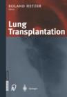 Image for Lung Transplantation