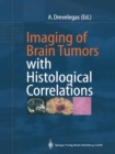 Image for Imaging of Brain Tumors with Histological Correlations