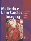 Image for Multi-slice CT in Cardiac Imaging: Technical Principles, Imaging Protocols, Clinical Indications and Future Perspective