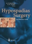 Image for Hypospadias Surgery: An Illustrated Guide