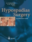 Image for Hypospadias Surgery : An Illustrated Guide